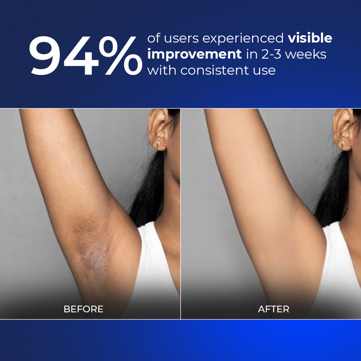 Image of Aqueria Multi Active Underarm Roll On | 5.5% AHA BHA, Niacinamide - Aqua Fragrance Deodorant Roll-on - For Men & Women