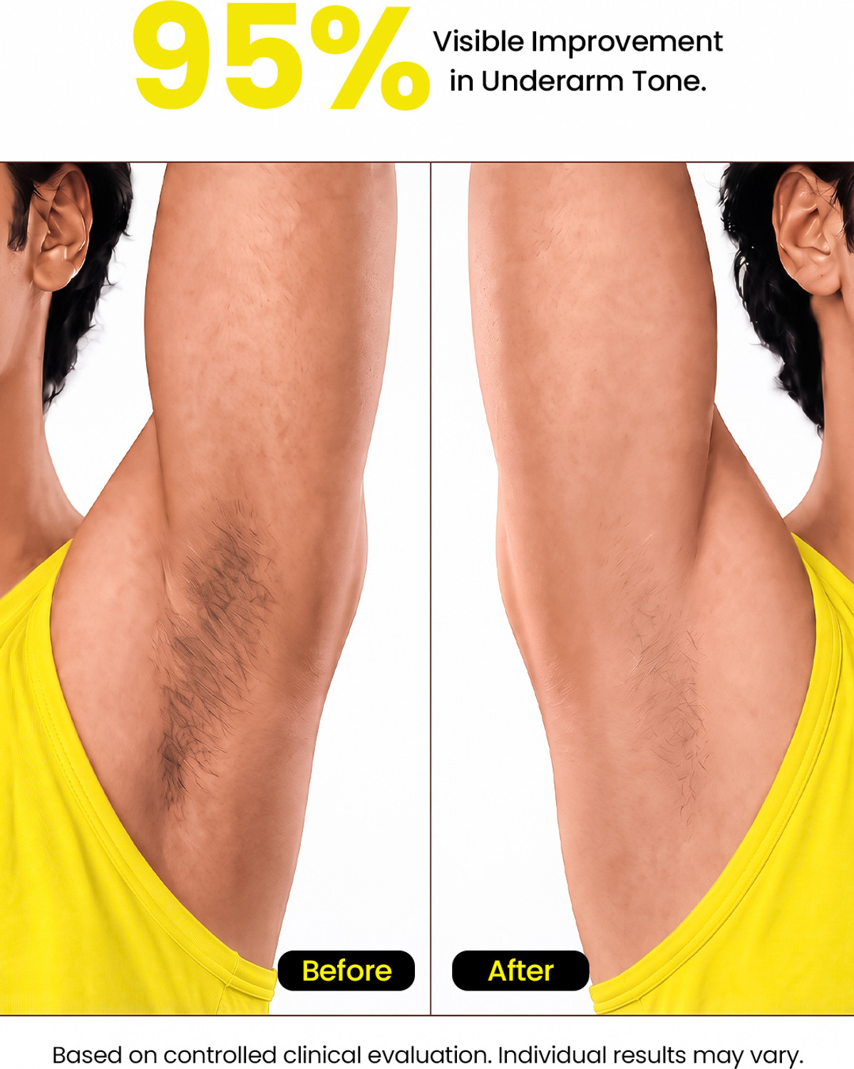 Image of OSCAR 10% AHA BHA Underarm Roll-On | Reduces Pigmentation & Odour | Aqua, Oud & Flora Deodorant Roll-on - For Men & Women