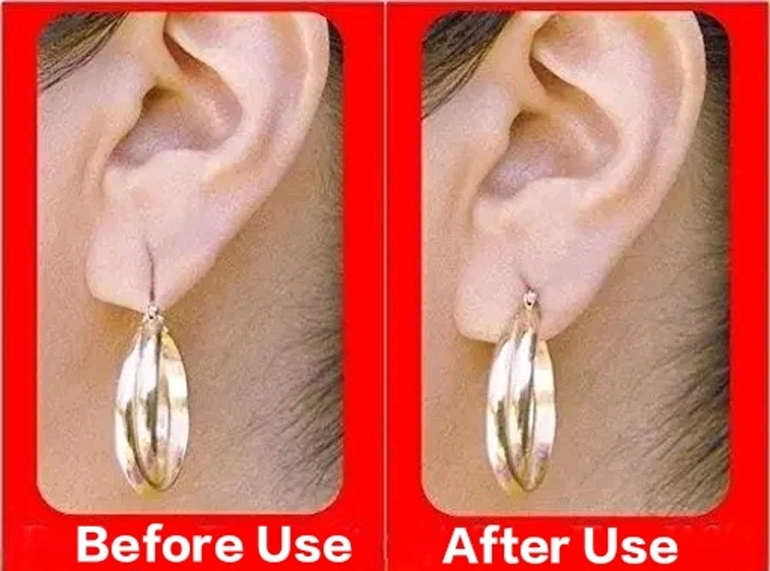 Image of Buyer Choice Disposable Ear Lobe Support