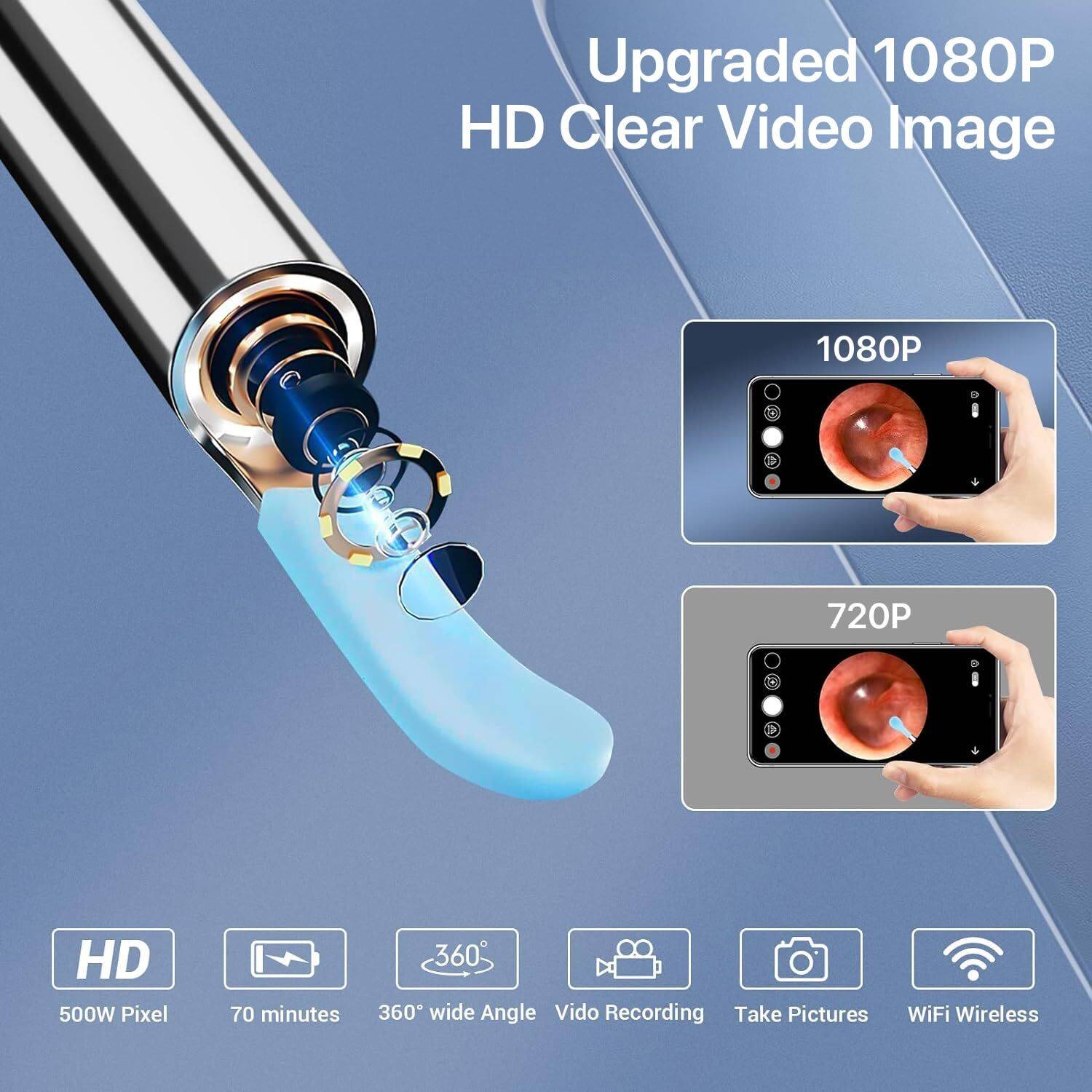 JYORESHA 1080P Electric Ear Cleaner with Camera - Image 3
