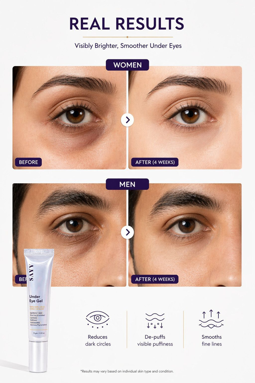 Image of SAYY Under Eye Gel for Dark Circles,Puffiness & Fine Lines Caffeine+Niacinamide
