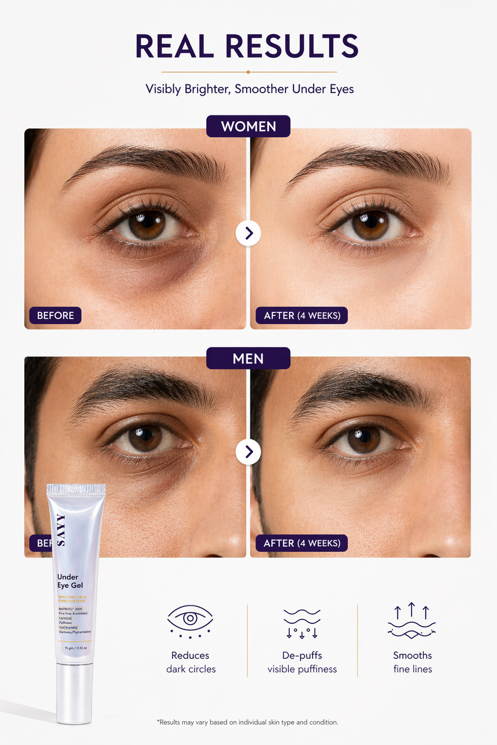 Image of SAYY Under Eye Gel for Dark Circles,Puffiness & Fine Lines Caffeine+Niacinamide
