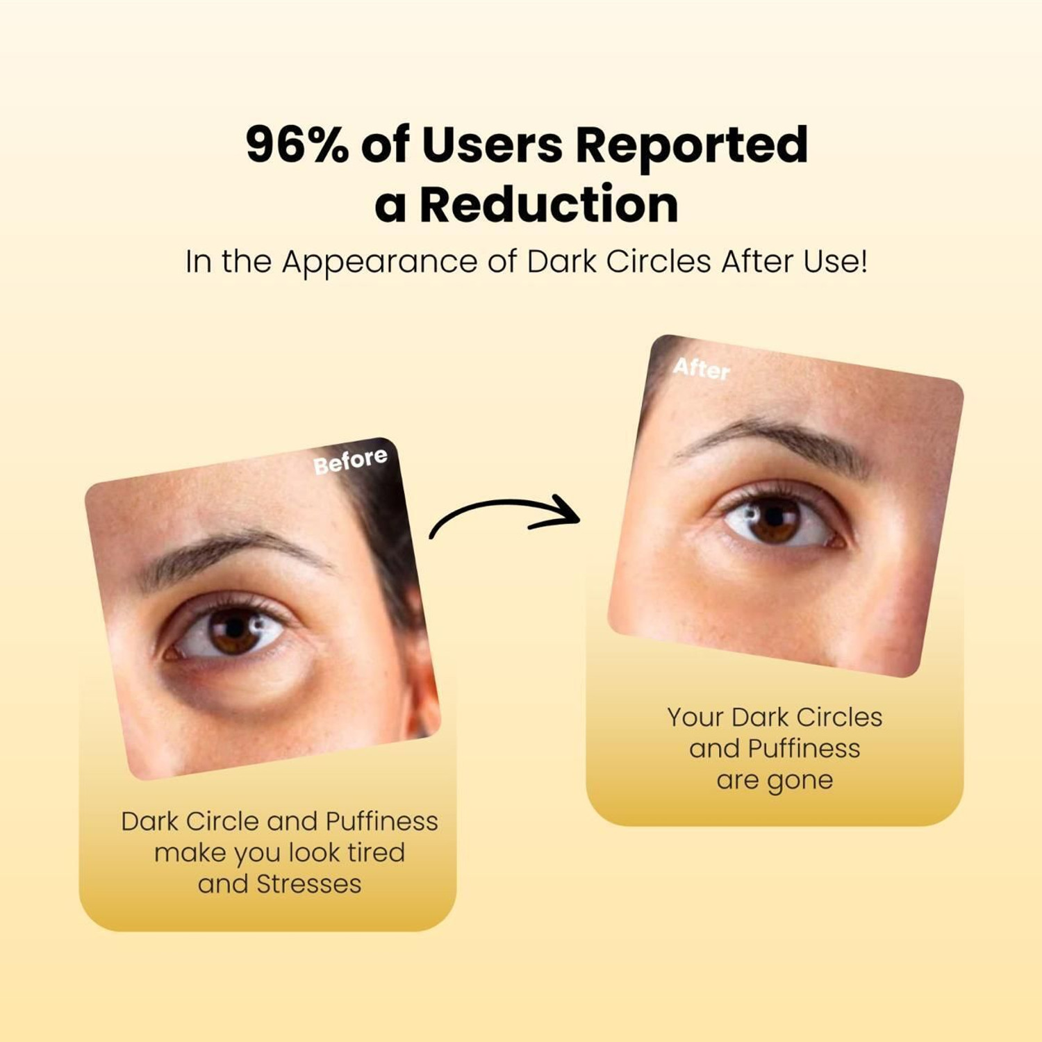 Image of Eyecirque Under Eye Gel Serum for Dark Circles, Puffiness & Fine lines - MONO