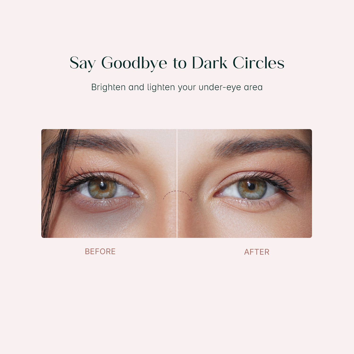 Image of Seoulskin Snail Mucin Eye Patches - Hydrates, Repairs, Reduces Puffiness & Dark Circles. (32 g)