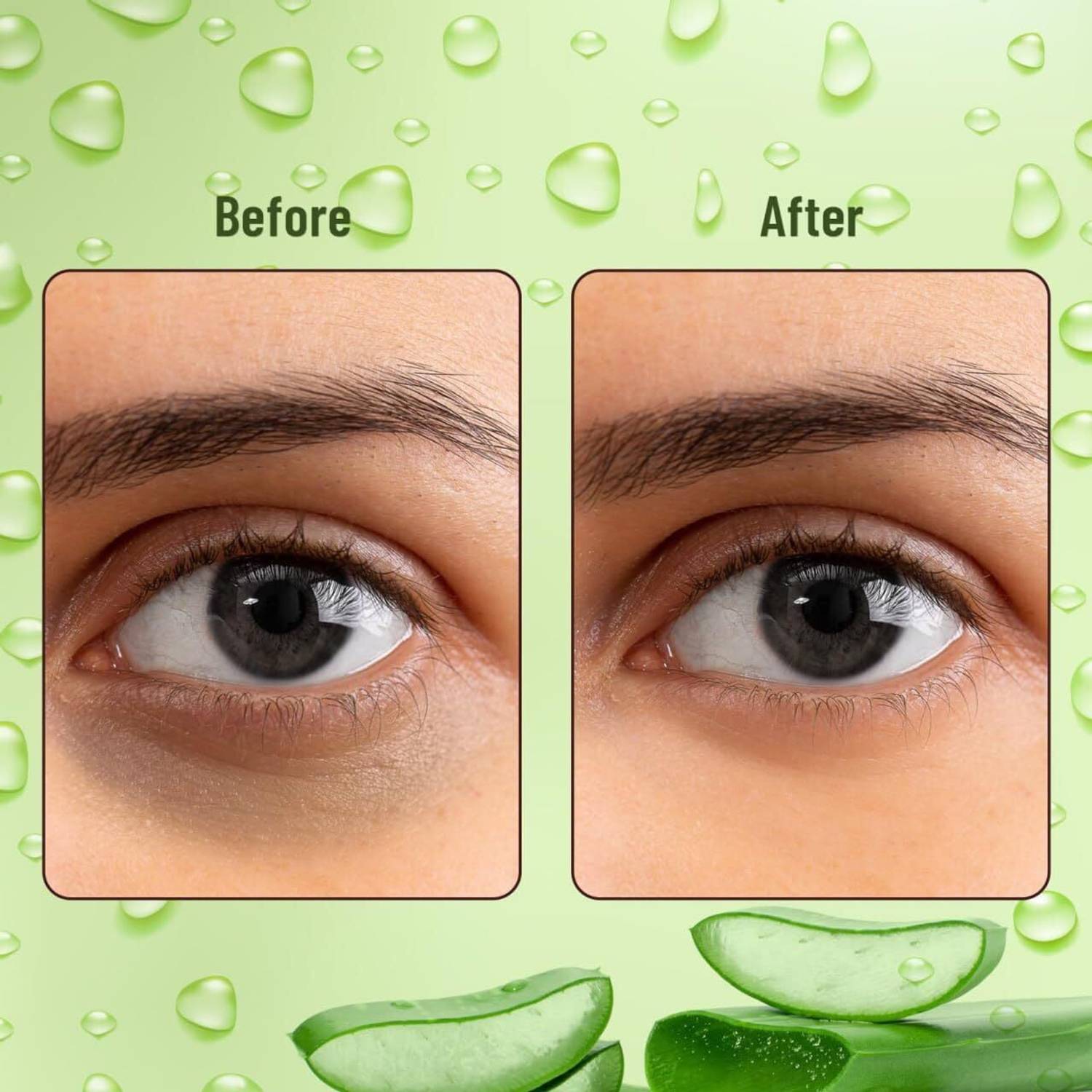 Avenoir Aloe Vera Eye Serum Patch for Dark Circles - Image 5