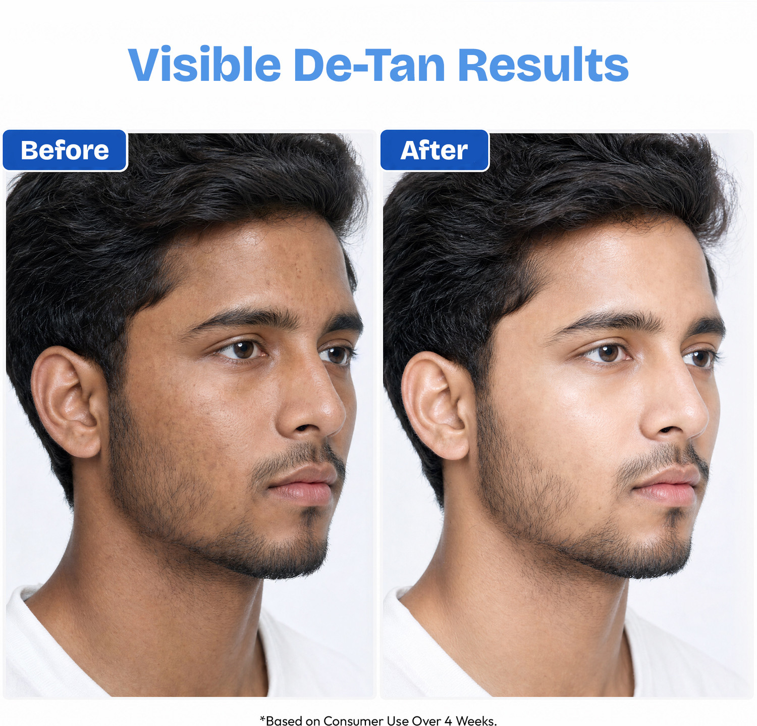 Image of proskire Moroccan De-Tan Brightening Face Mask for Instant Tan Removal & Skin Brightening