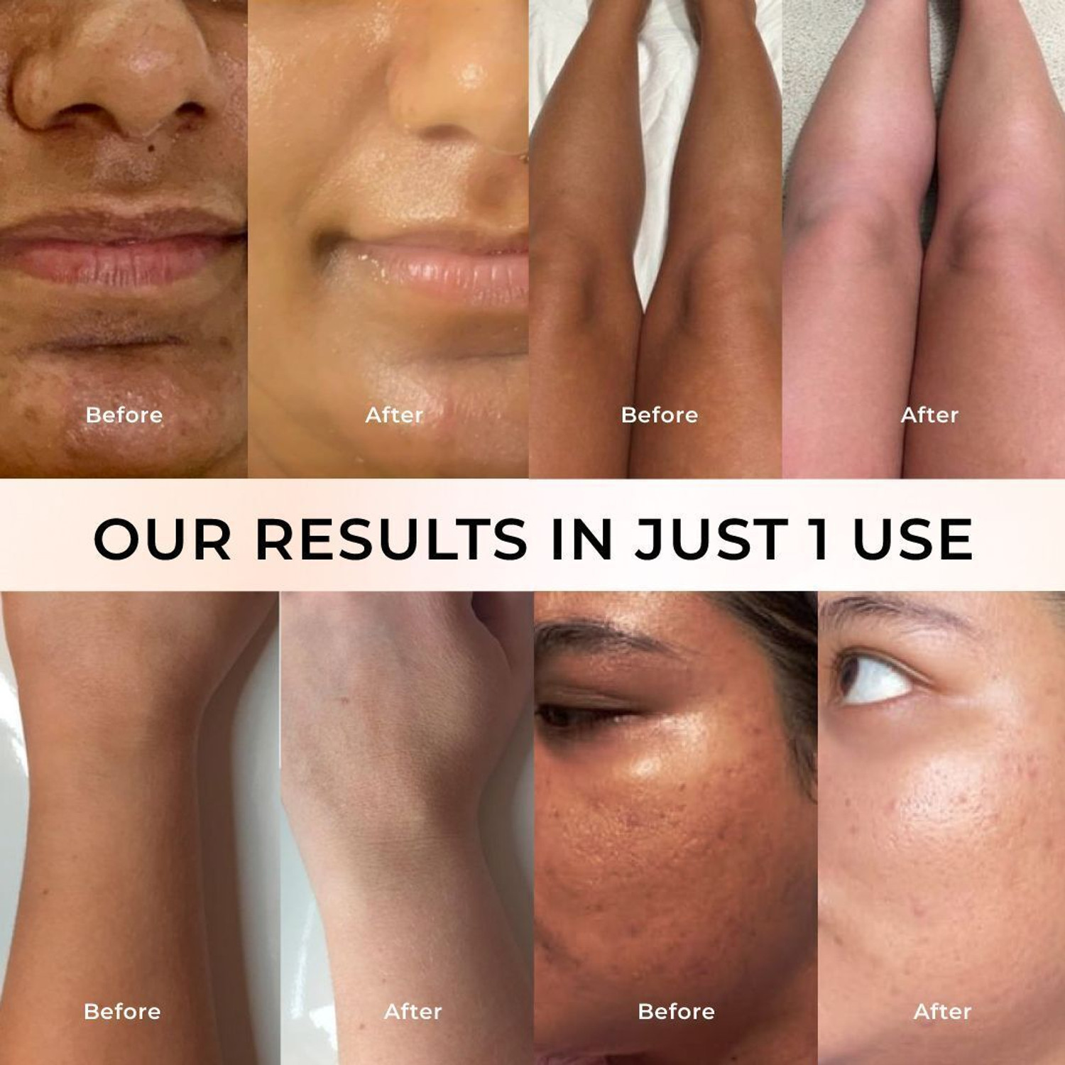 Image of Niconi Gluta-Kojic Instant Tan Removal & Tan Vanish With Glutathione, For All Type Skin