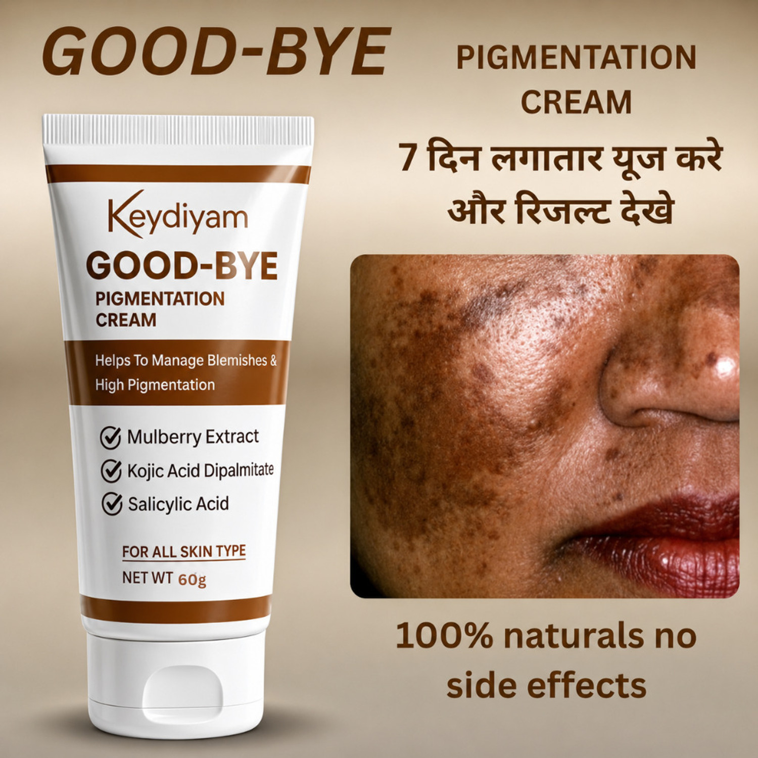 Image of DRIDDLE Pigmentation removal cream for women Acne Scar Removal Dark Spots Stretch Mark (100 g)