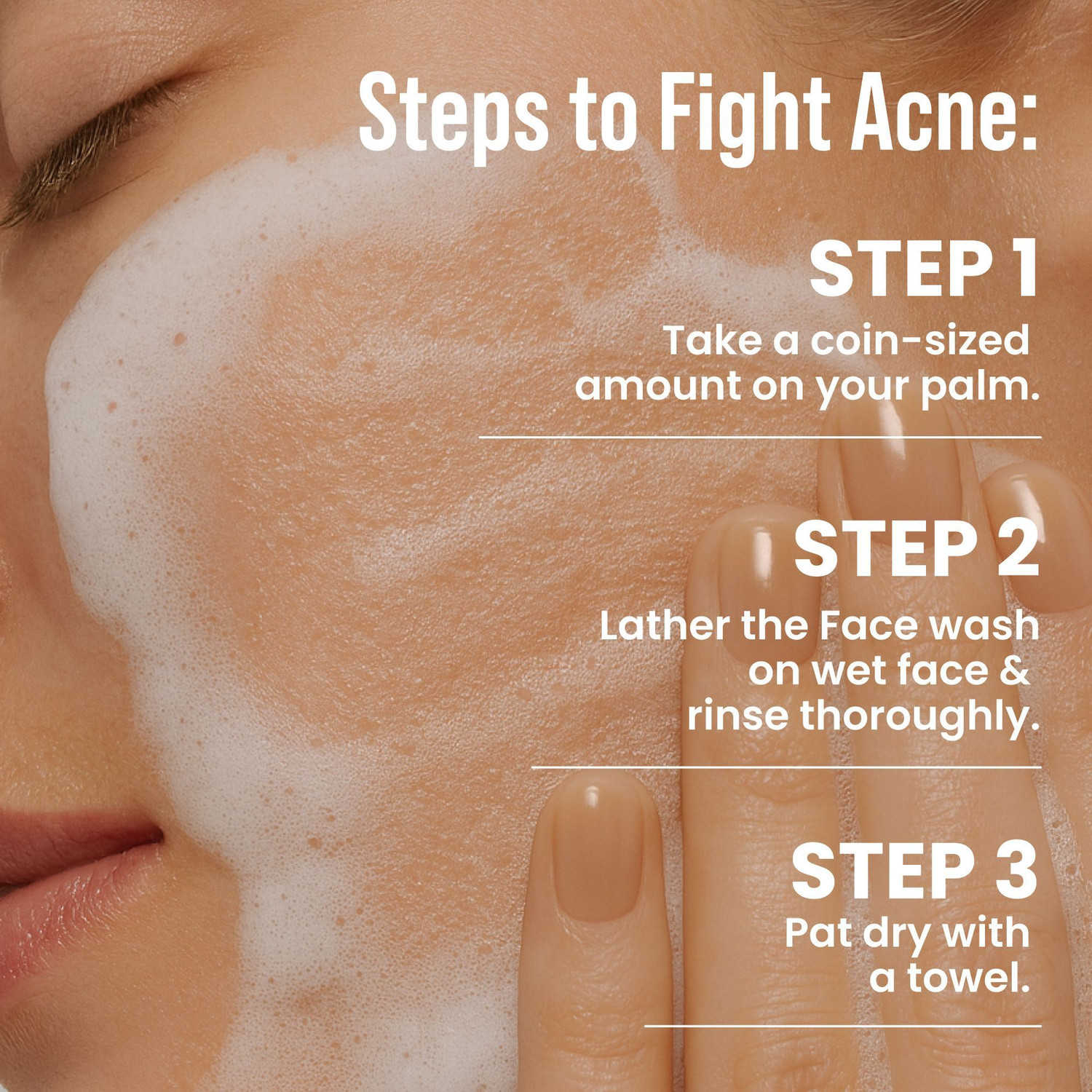 Image of Ghar Soaps Anti Acne | With Salicylic Acid, Neem & Niacinamide Face Wash