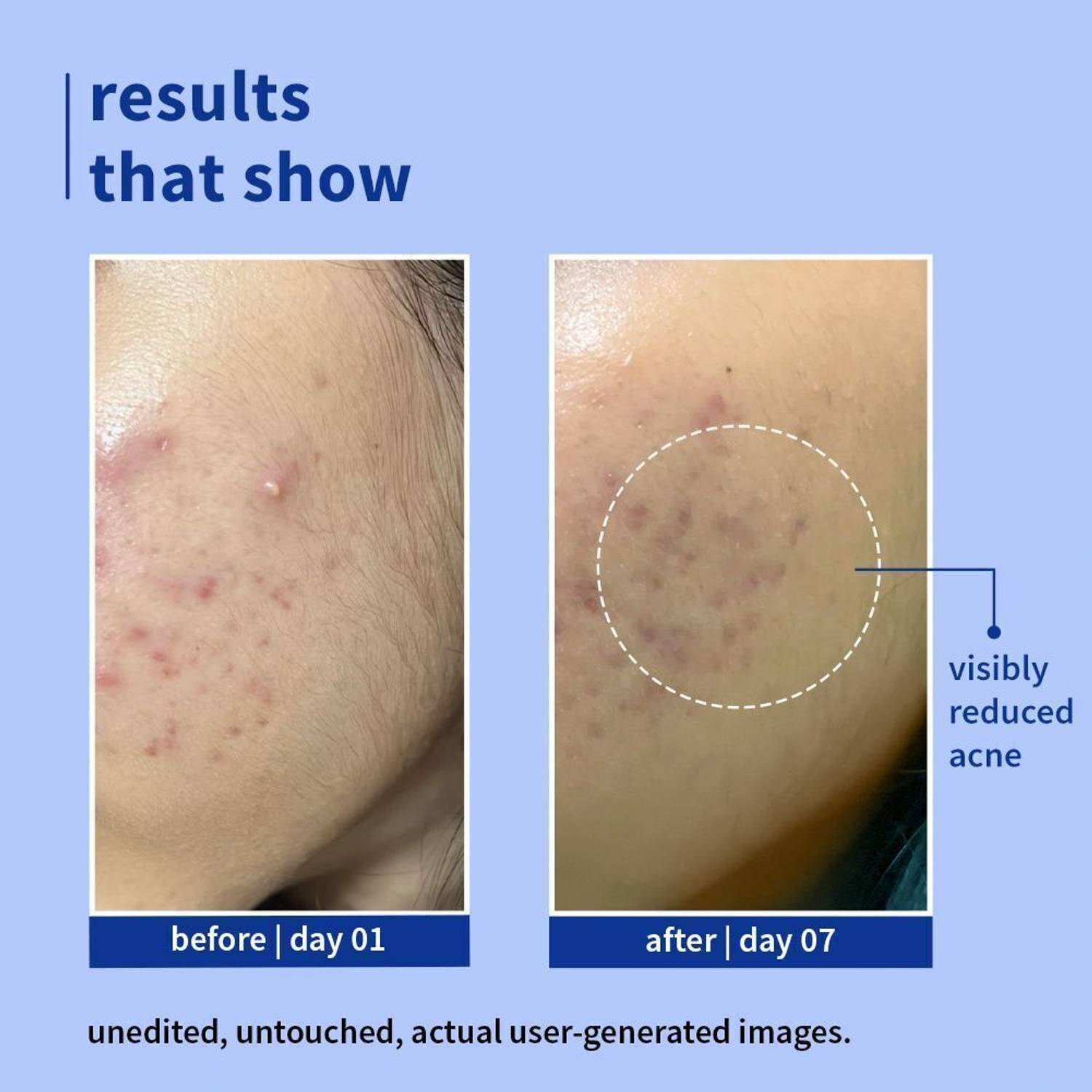 Plum 1% Salicylic Acid Cleanser For Oily Skin 100/110 ml - Image 3