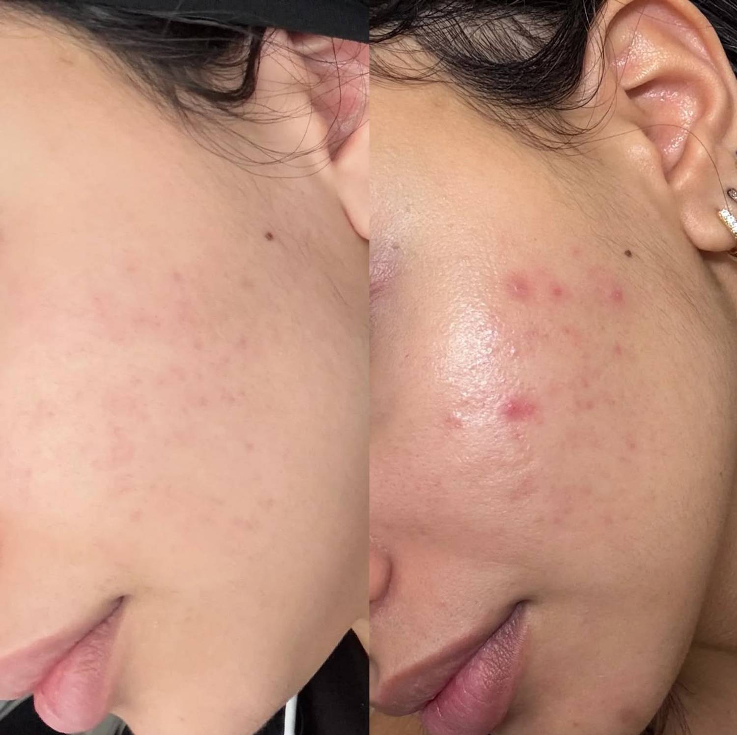 AGLEY Multani Mitti Face Wash with 1% Salicylic Acid - Image 5