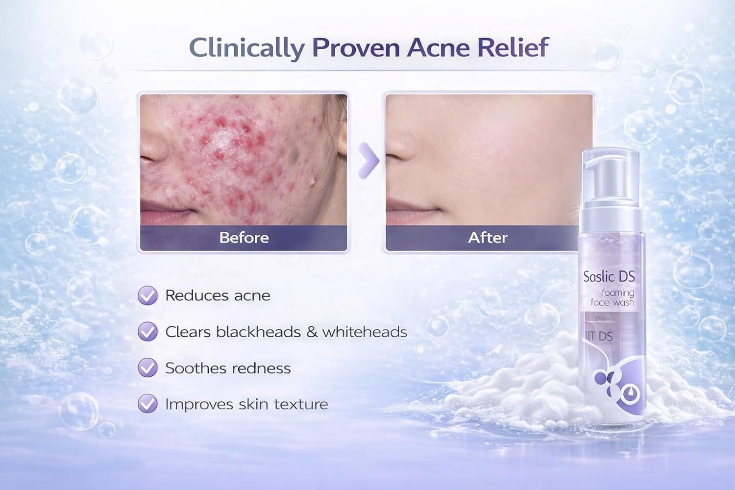 Image of Ringas SASLIC DS FACE FOAM Face Wash