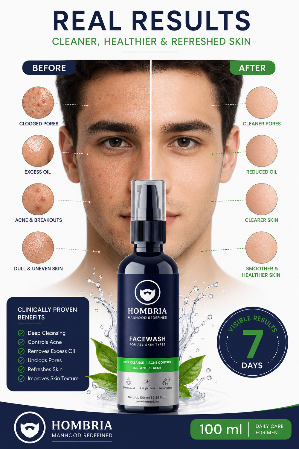 Image of HOMBRIA Facewash for Men, Fights Acne & Pimple, Clear Pores, Brightening, All Skin Types Face Wash