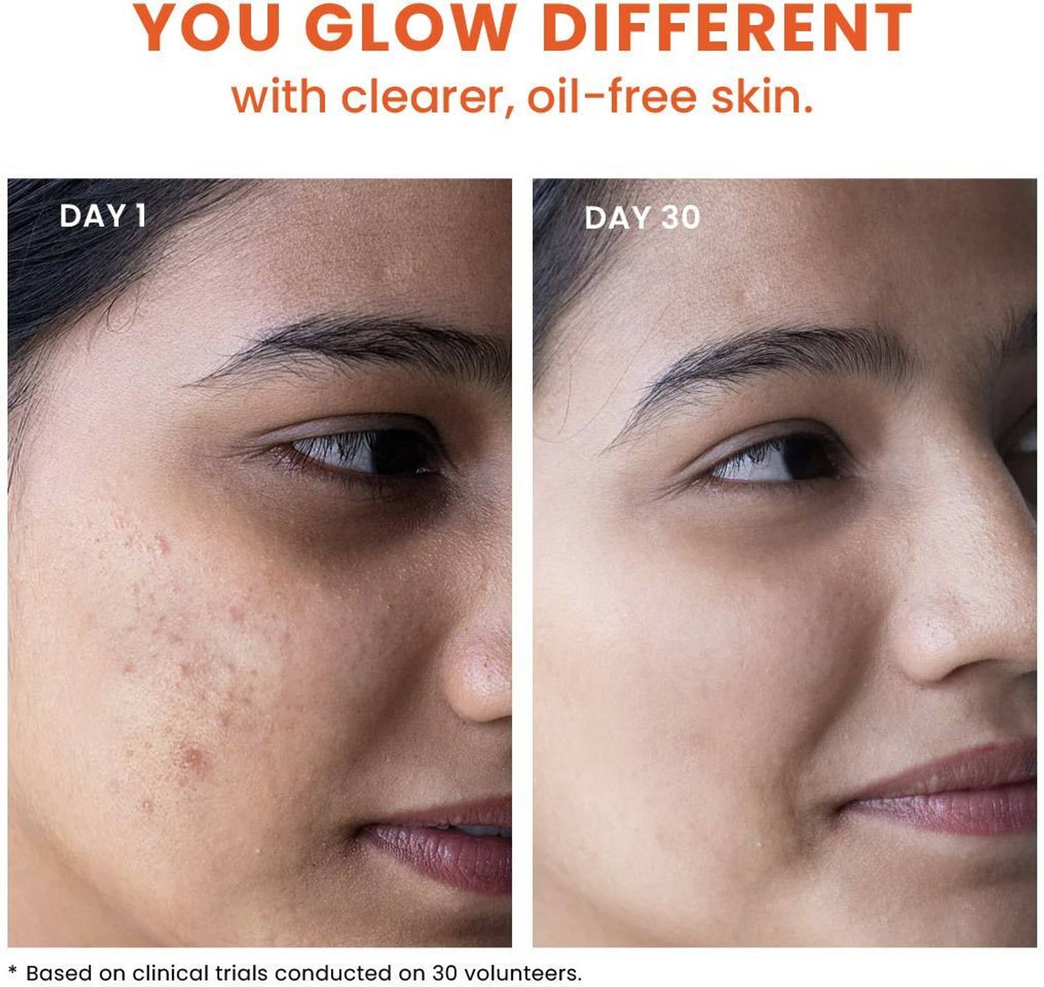 Foxtale Clear Picture Acne Control Cleanser - Image 5