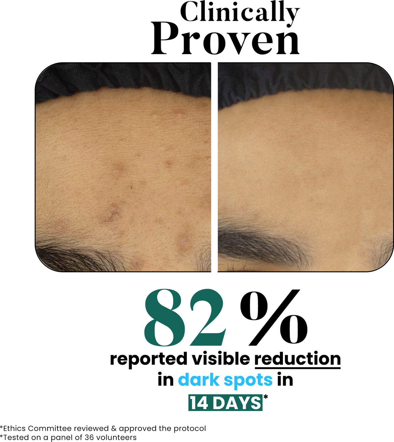 Image of BIO CODE Tranexamic Acid & Vitamin C Brightening & Even Tone | AI-Enhanced Formula | Dermatologist Recommended | 150ml Face Wash