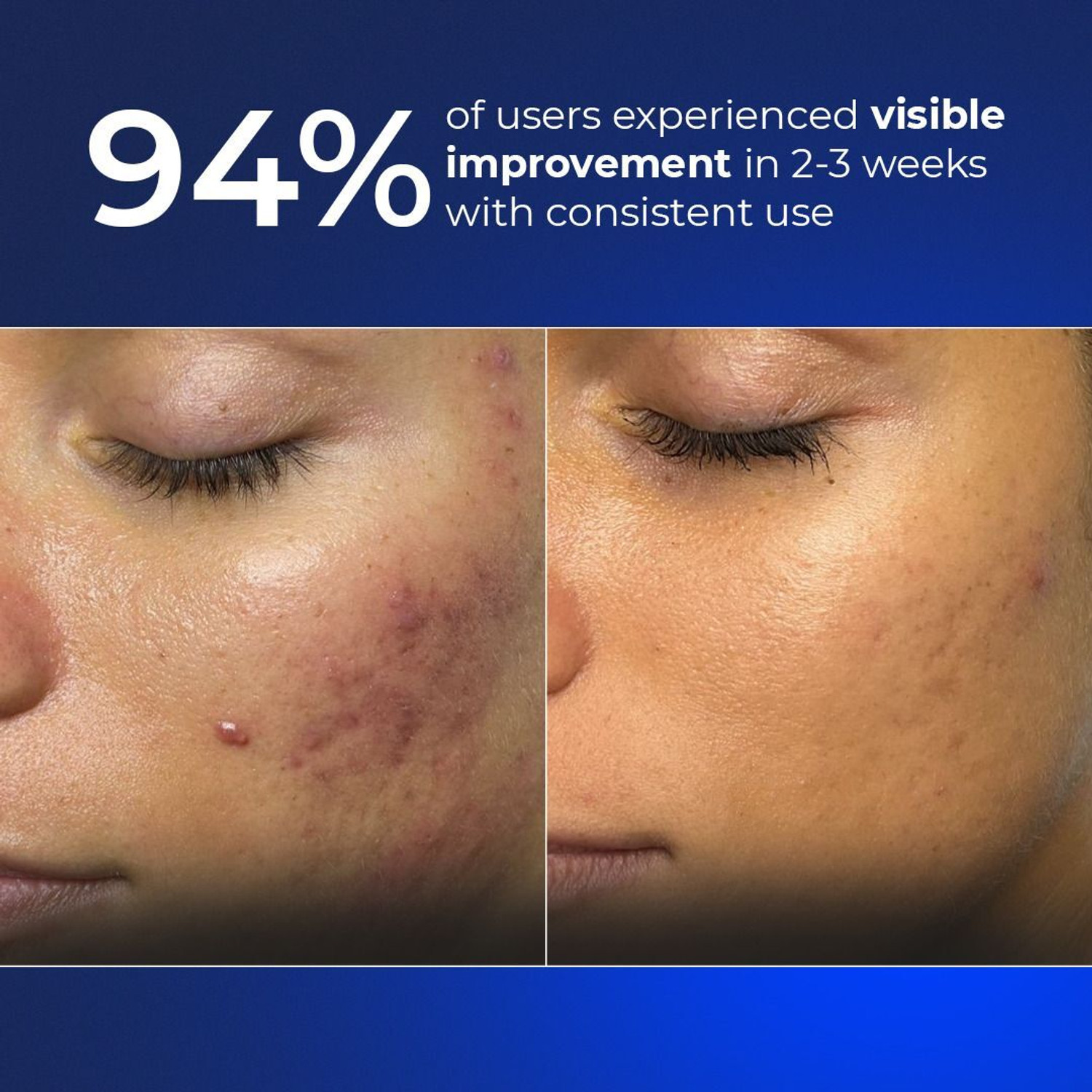Image of Aqueria 3% Niacinamide Hydrating & Brightening French Gentle Cleanser | Normal to Dry, Sensitive Skin Face Wash