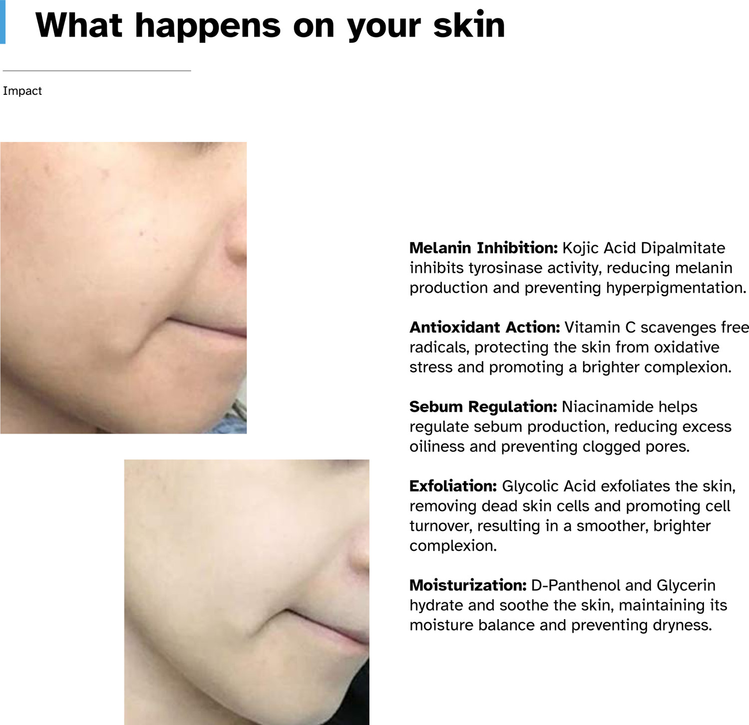 Image of Aecxo Glo 2% Kojic Acid With 3% Niacinamide Daily Brightening Gentle Face Wash