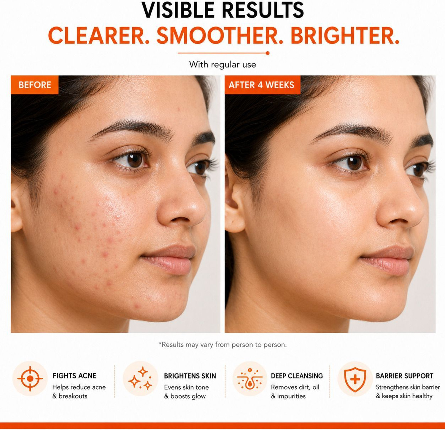 Image of Skin Molecule Anti Acne Facewash with Mandelic Acid & Vitamin C | Deep Cleansing Face Cleanser for Acne Prone Skin | Brightens & Smoothens Skin Face Wash