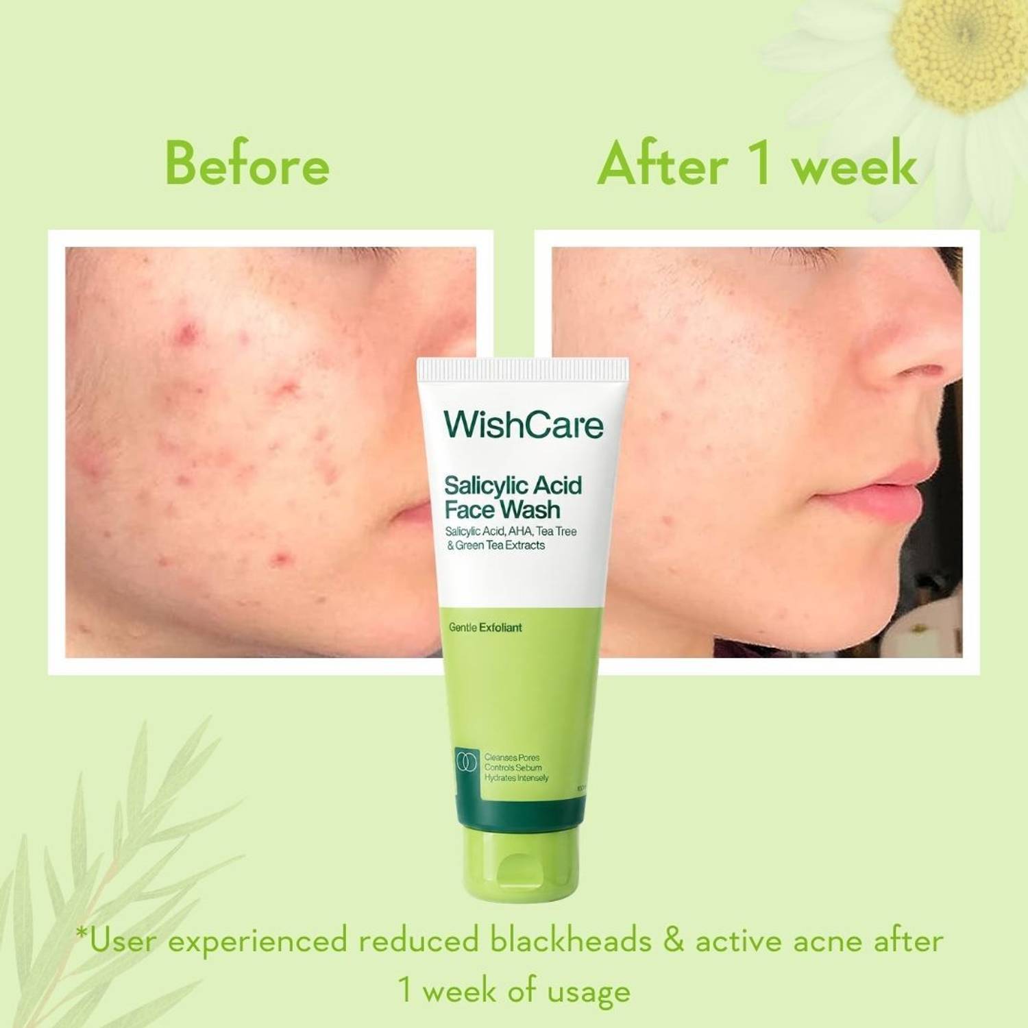 WishCare 2% Salicylic Acid Acne Control Face Wash - Image 4