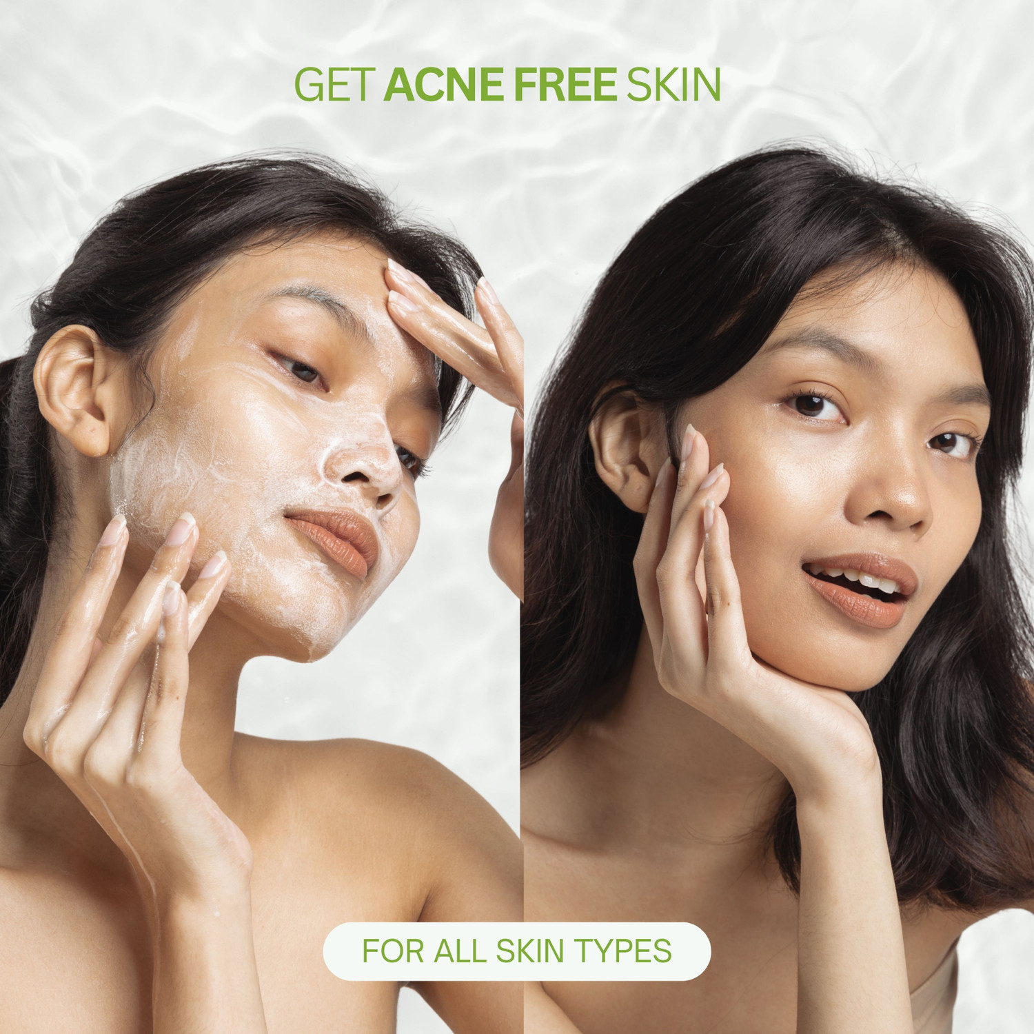 Image of DermaTreat Essentials Anti Acne With 2% Salicylic Acid, 1% Glycolic Acid & 3% Niacinamide for Active Acne, Pigmentation & Even Tone Skin Face Wash