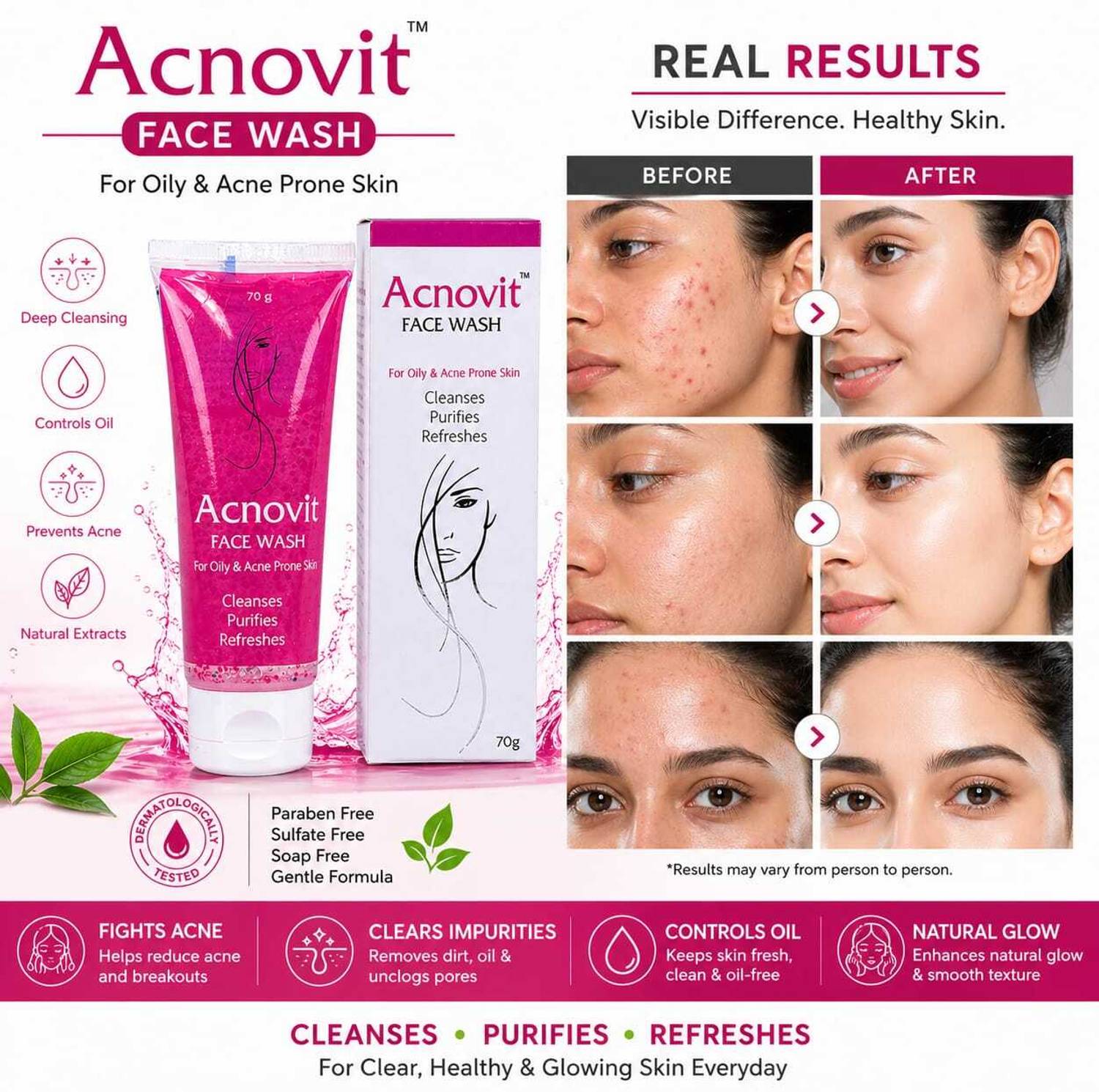 ACNOVIT  for Oily & Acne Prone Skin | Oil Control, Anti-Pimple & Deep Cleansing Gel | Paraben, Sulfate & Soap Free | Natural Extracts Face Wash