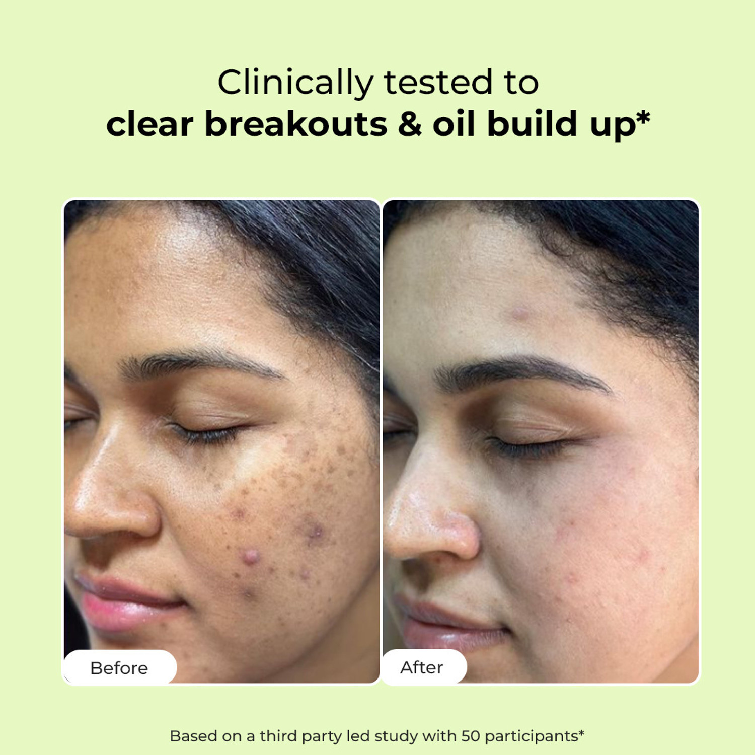 Image of Conscious Chemist Daily for Oily & Acne Prone Skin | Deep Cleansing, Oil Control & Pore Care | Pack of 2 Combo Face Wash