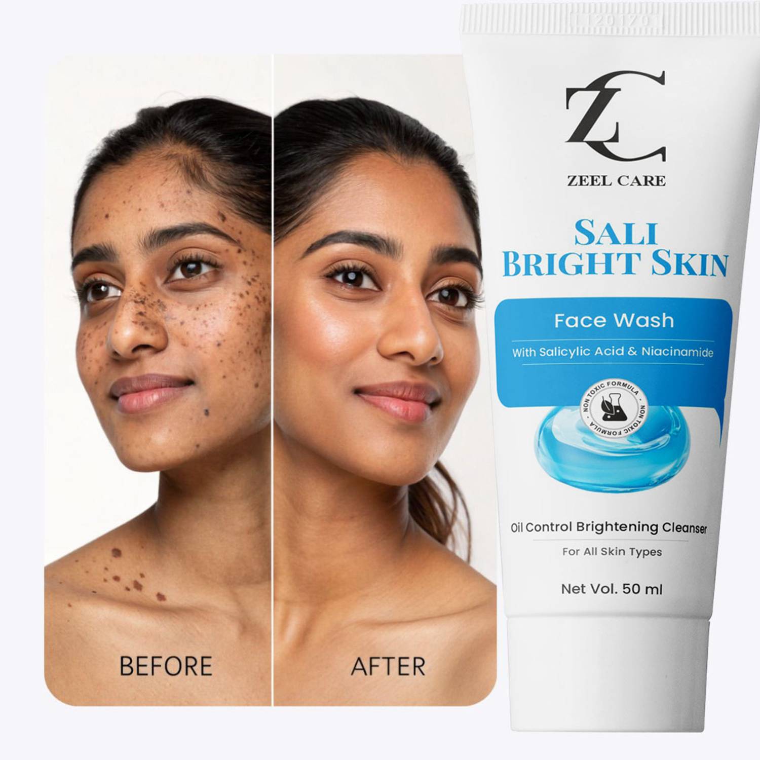 Zeel Care Salicylic Acid 2% for Pimples Acne Breakout Control Fa