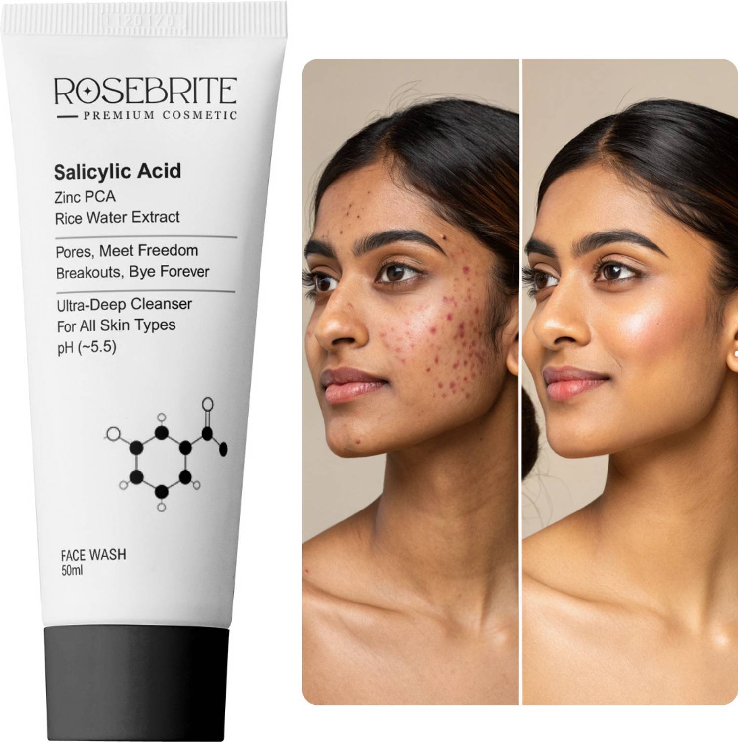RoseBrite 2% Salicylic Acid for Acne-Prone Skin with Zinc PCA &