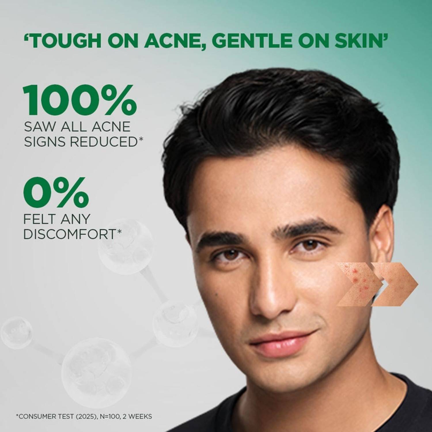 Garnier Men Acno Fight Gentle Cleanser Face Wash 300g - Image 4