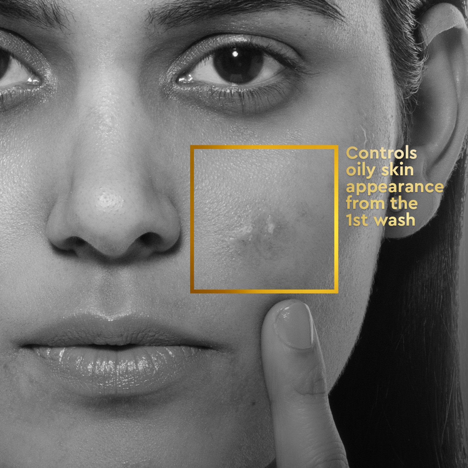 Image of VLCC Clinic Anti Acne | For oily & acne prone skin | Acne control, oil control Face Wash