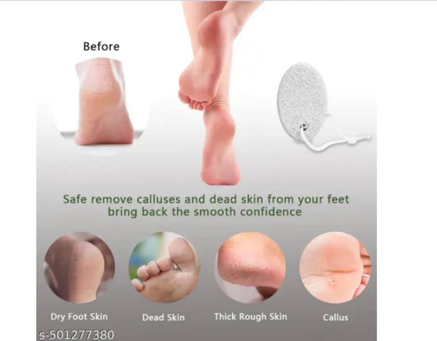 Image of Leysin Foot Scrubber For Clean And Soft Feet For Dead Skin /Cracked