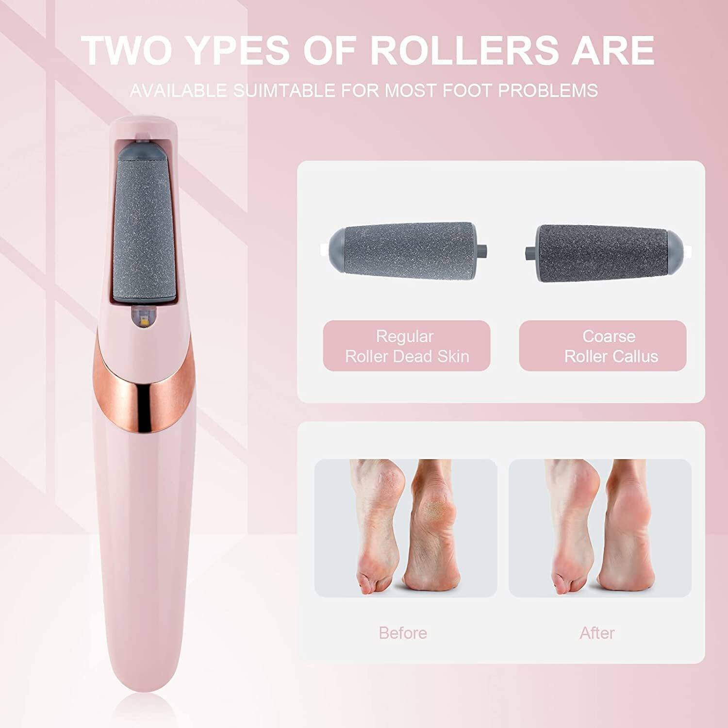 ACLIX Finishing Touch Flawless Pedi Electronic Pedicure Tool File and Callus Remover