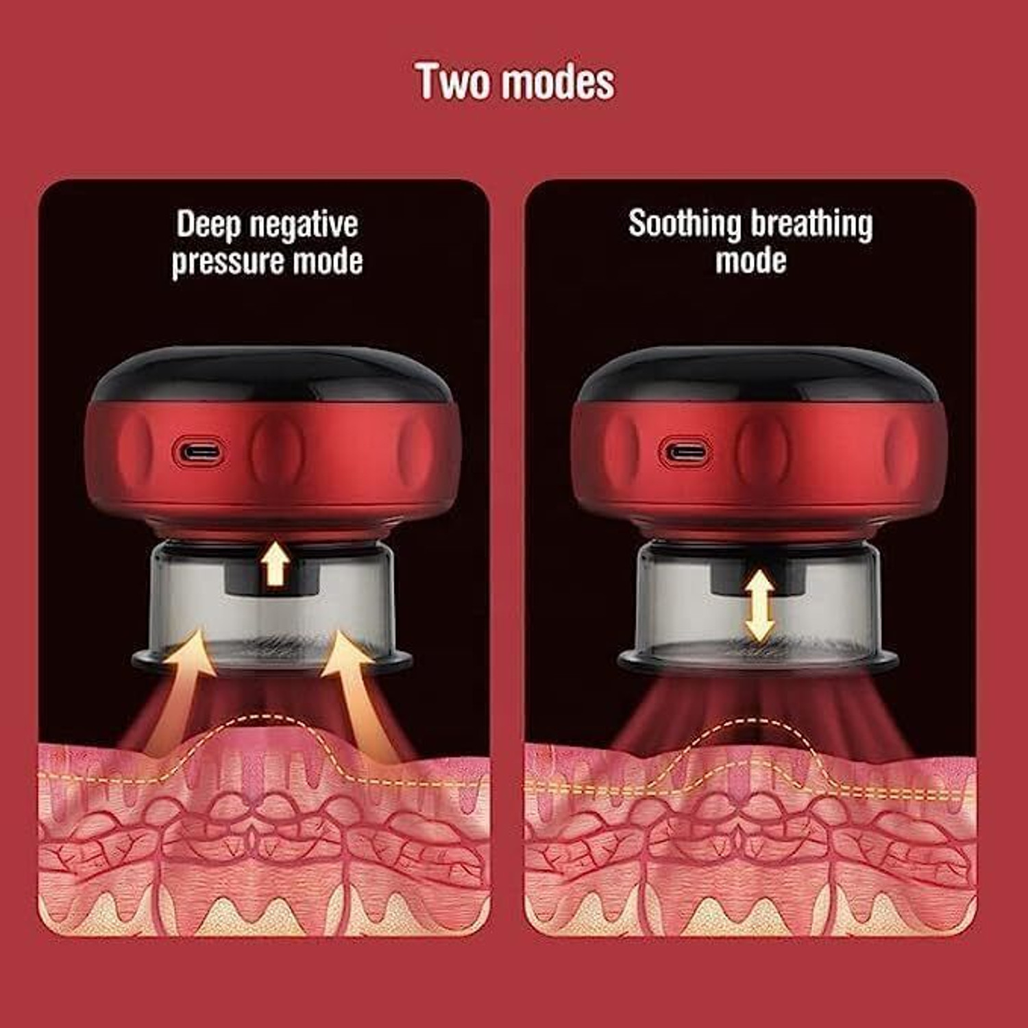 Image of SKYBUCKET Dynamic Electric Cupping Device - 5 Massage Modes With Heating Therapy,