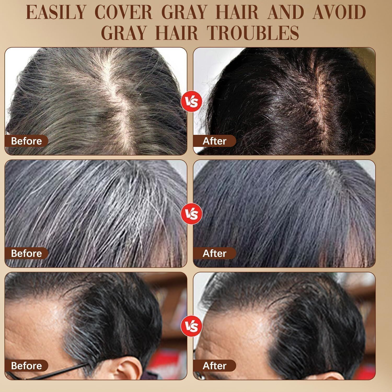 Image of SOMIYO Instant Hair Color Stick Comb, Waterproof Quick Root Touch Up for Gray Hairs , Black