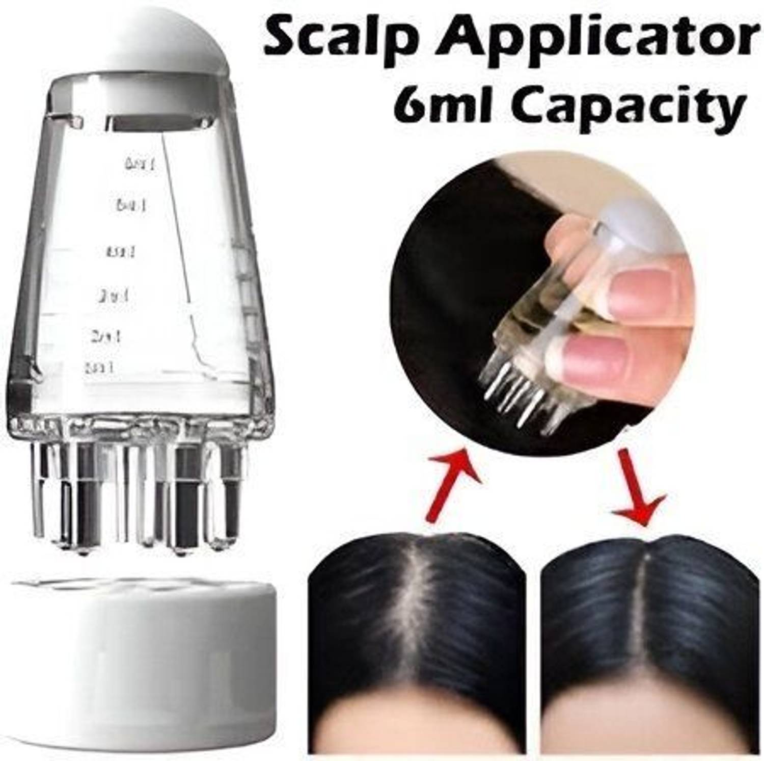 EVANSHIIIMPEX radhe Scalp Applicator - Image 3