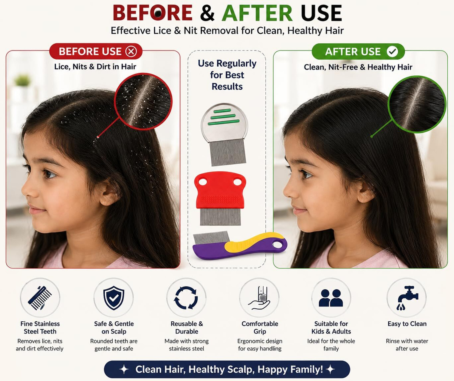Image of TRESSENCE 3PC - Stainless Steel Lice Removal Comb Set (3Pc Combo)