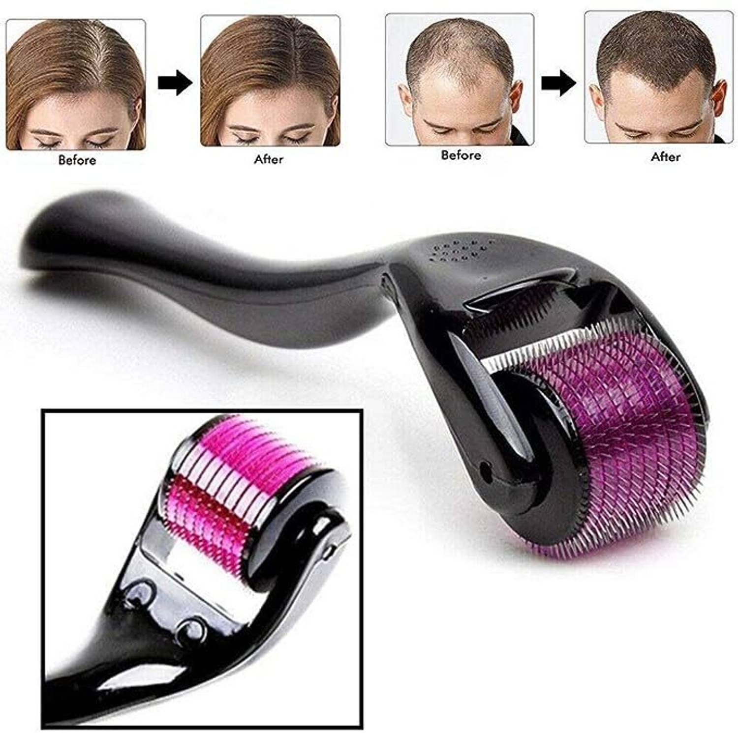 HSNAYIR Derma Roller 0.5mm for Beard Growth and Skin Care Roller for Men Hair Curler - Image 1