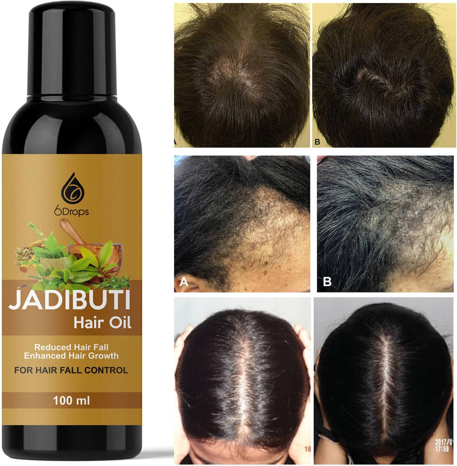 6Drops Natural Hair Growth - Regrowth Ayurvedic Hair Oil