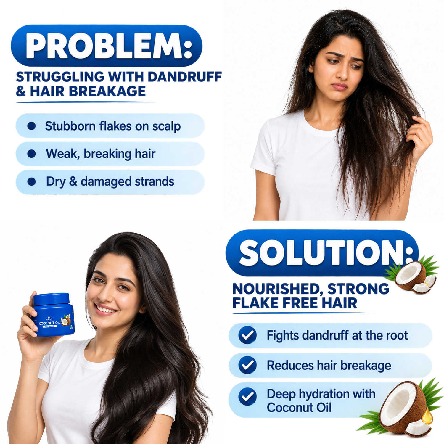 Image of VETONI 100% Cold Pressed Coconut Oil with Vitamin E for Hair & Skin Hair Oil (200 ml)