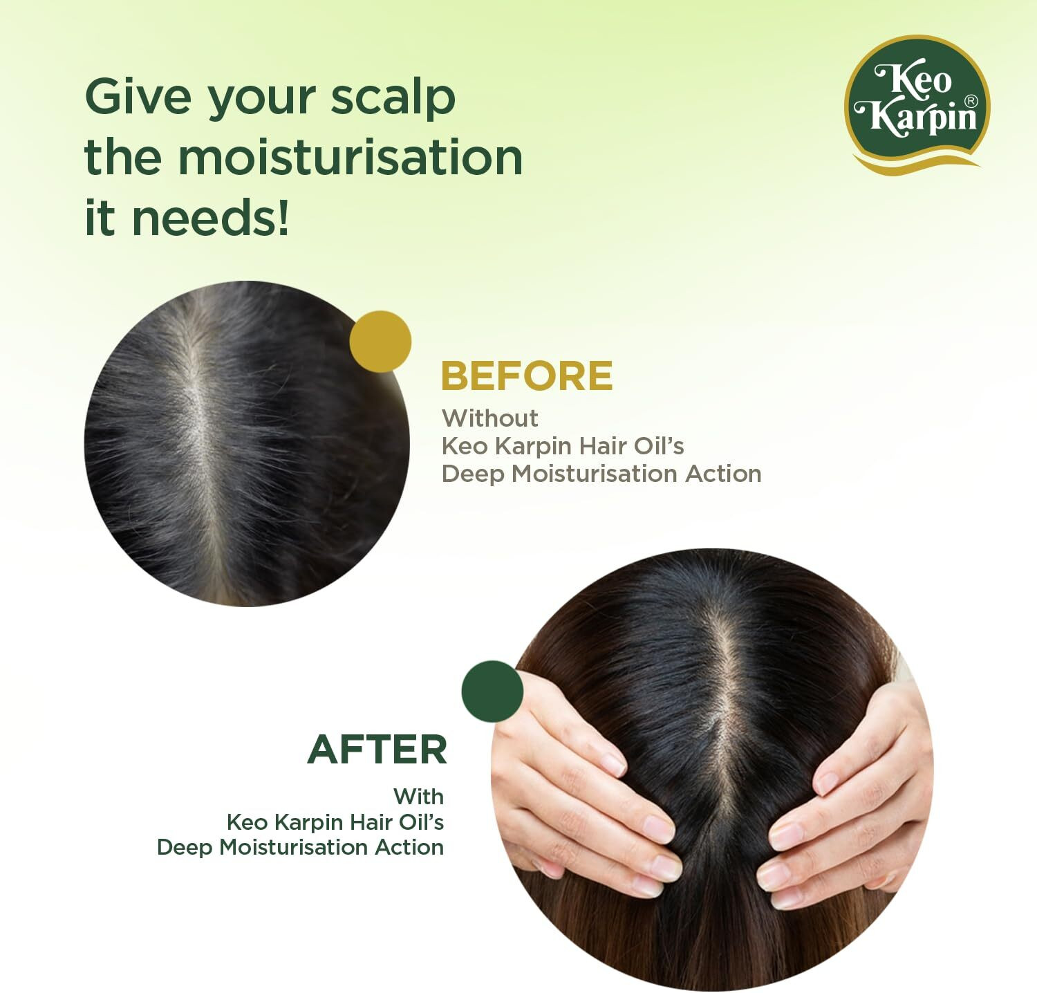 Image of Keo Karpin Hair Oil, Enriched With Natural Vitamin E And Olive Oil Hair Oil
