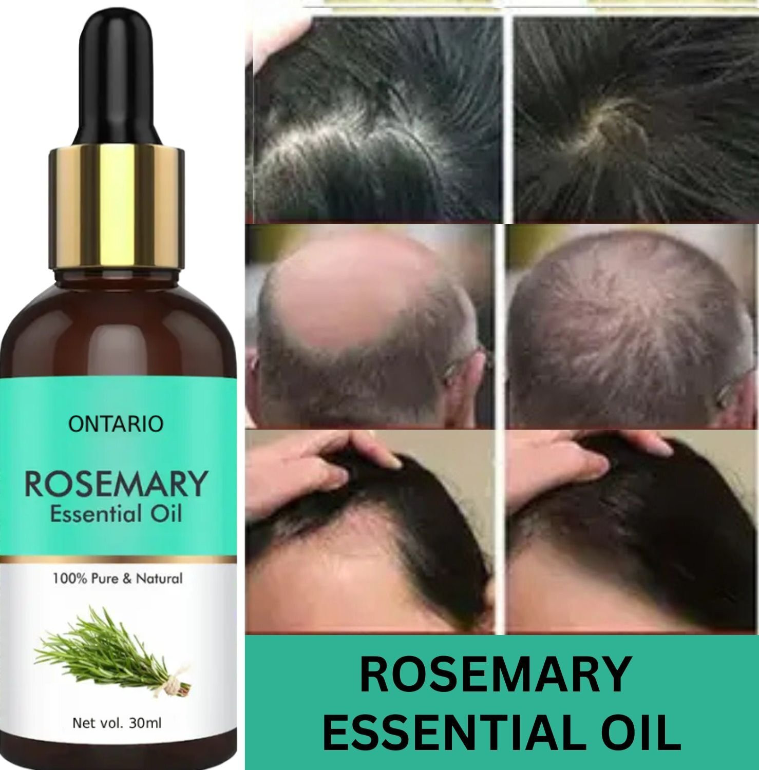 Image of Ontario Rosemary Oil, 100% Pure Oil for Hair Growth, Hair Fall Control Hair OilAX1.14 Hair Oil