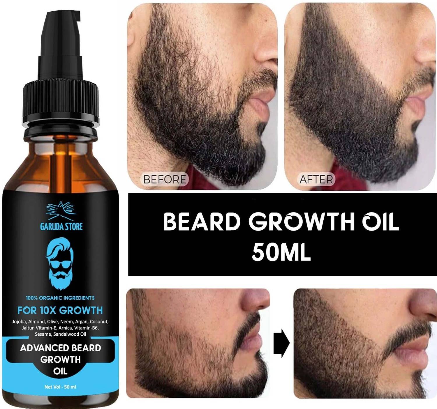 Garuda Store Say Goodbye to Patchy Beard - Nourishes, Softens, an
