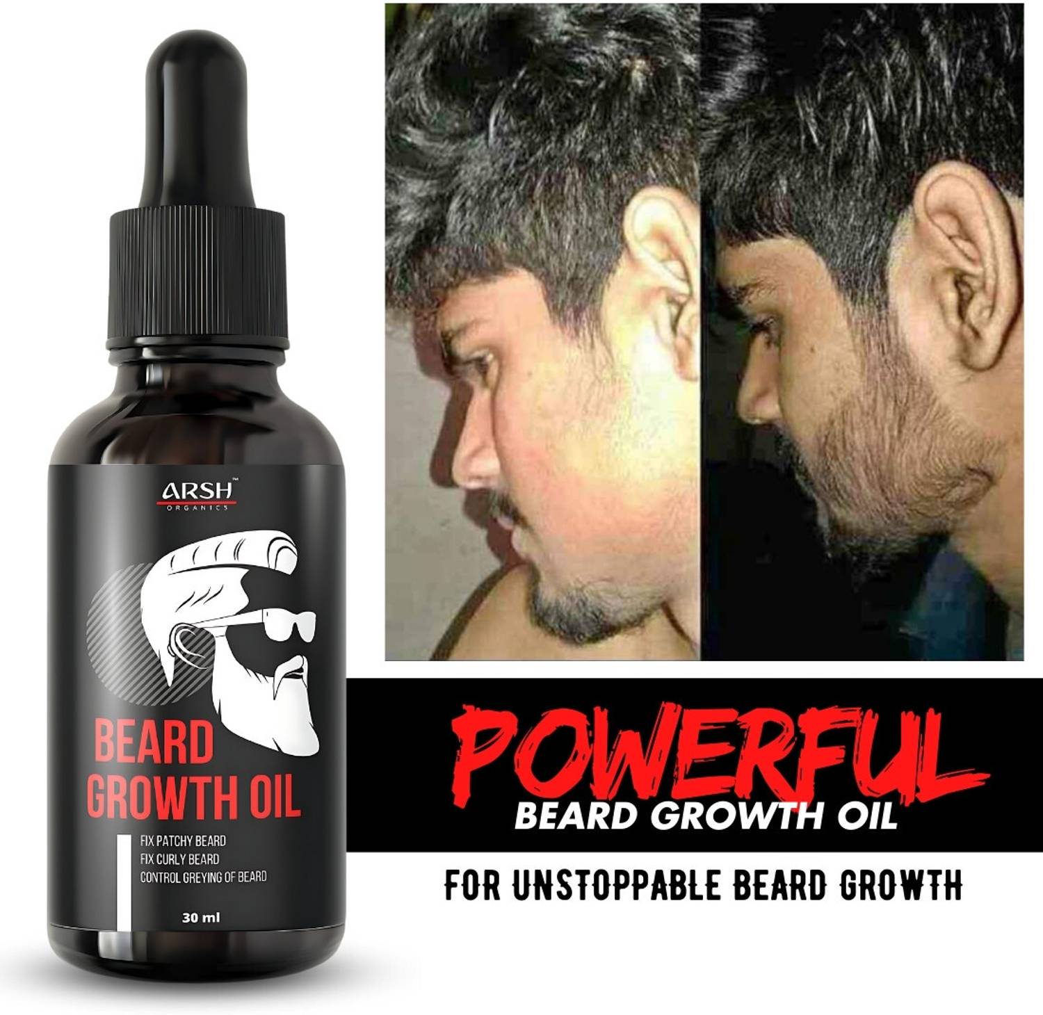 Arsh Organics "Grow Your Confidence: Our Beard Growth Oil Solutio