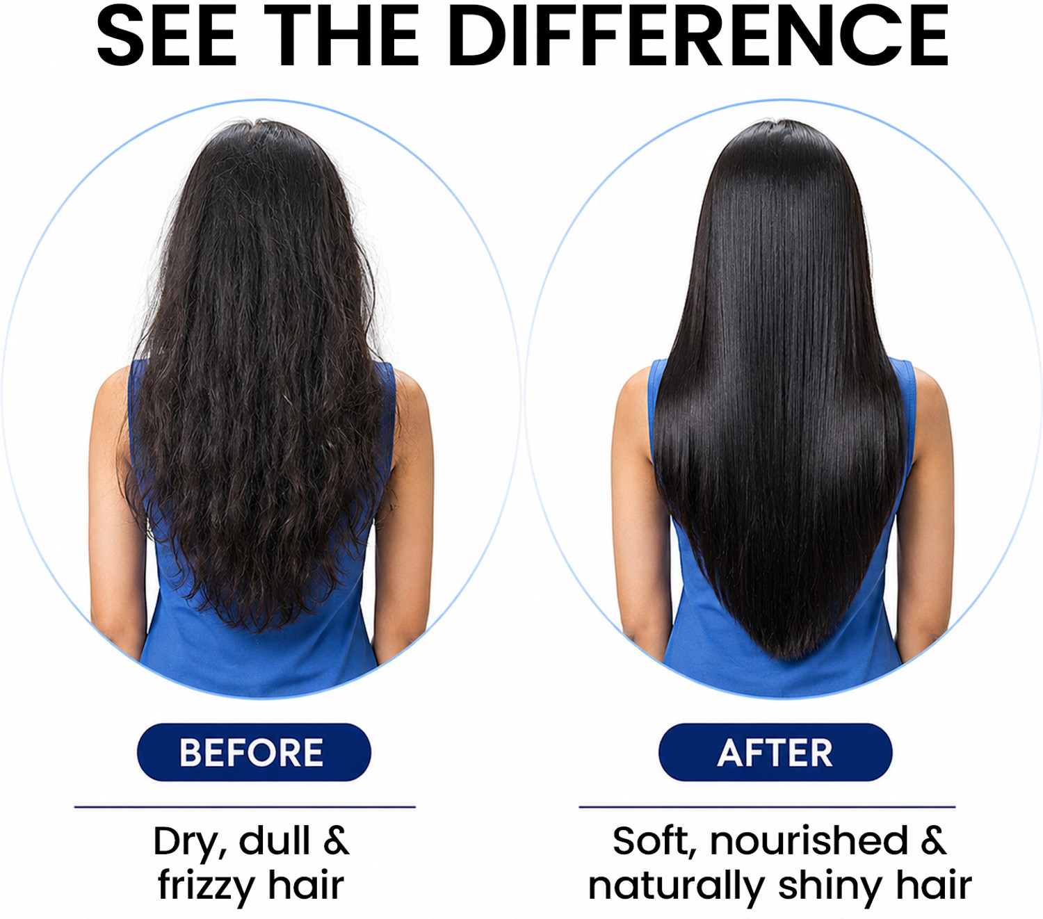 Image of VETONI 100% Cold Pressed Coconut Oil with Vitamin E for Hair & Skin Hair Oil (200 ml)