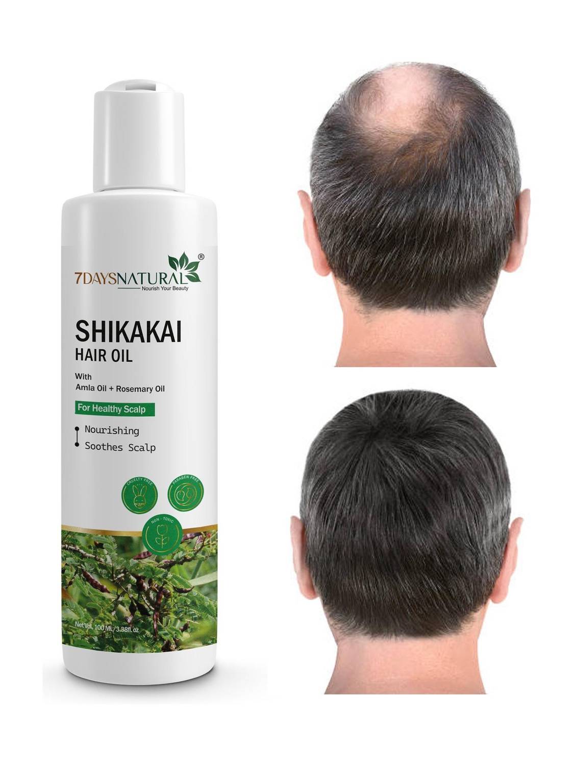 7days natural Shikakai Dasabuti Hair Oil for Hair Growth Hair fall, With 16 Herbs Hair Oil