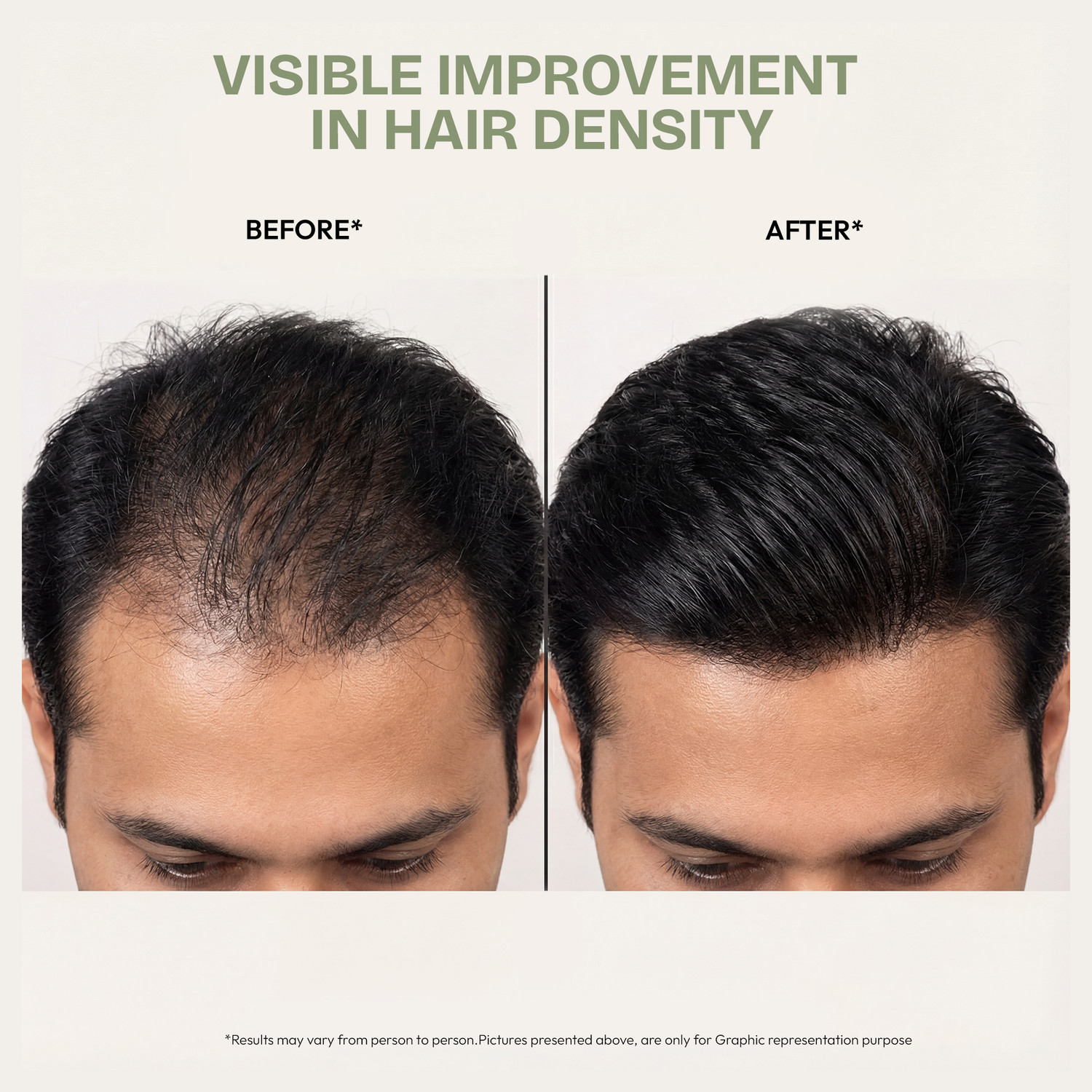 Image of Proskire Ultimate Hair Growth Oil |Reduces Hair Fall & Promotes Hair Growth|Lightweight 2 Hair Oil