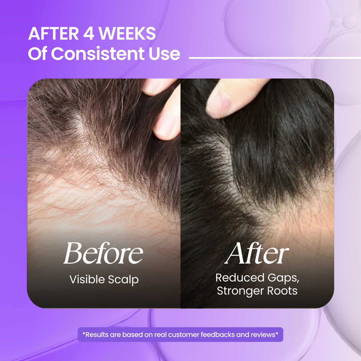 Image of Glosseo Rosemary Premium Hair Oil 700 ml | Hair Growth Oil | Helps Reduce Hair Fall Hair Oil