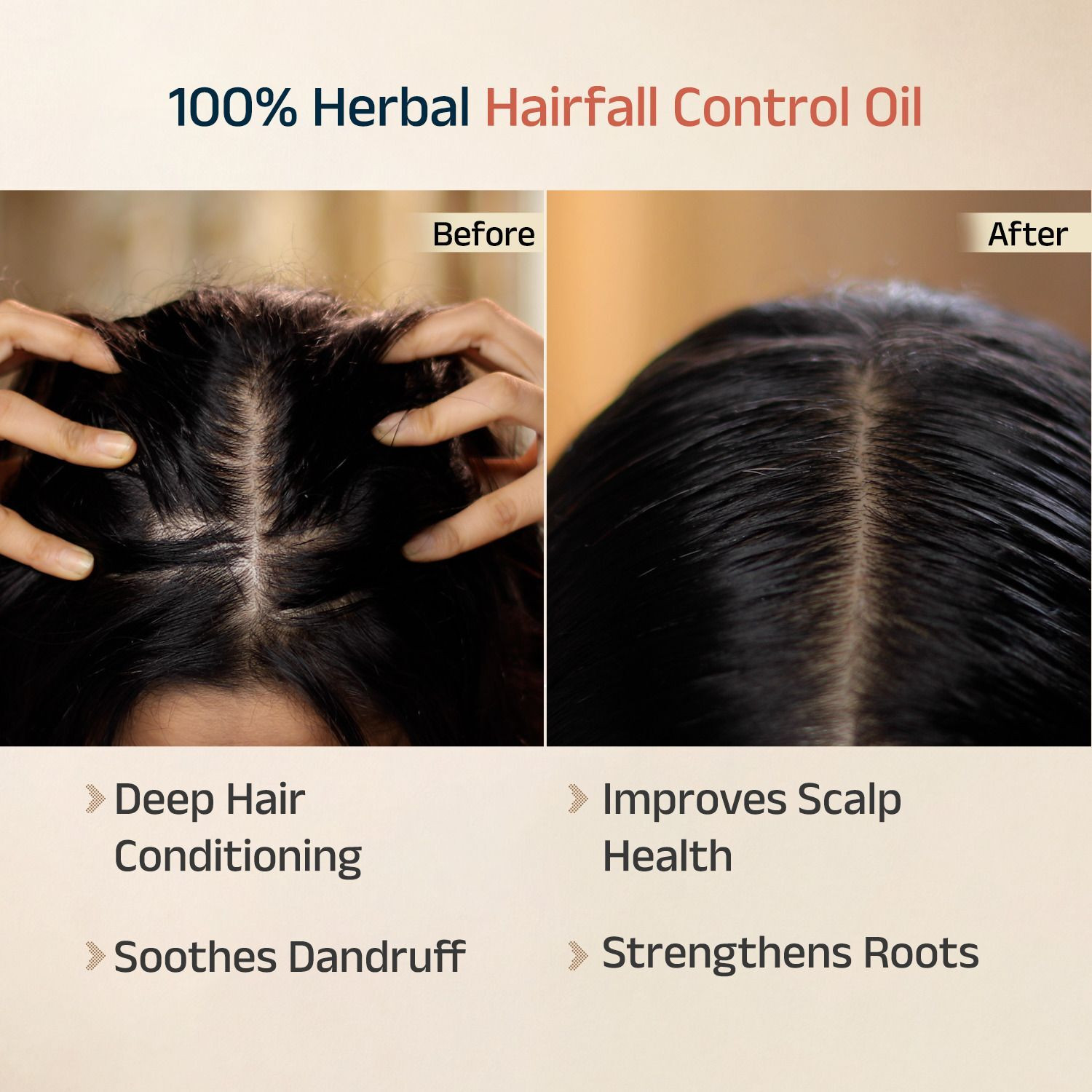 Image of Vedix Keshamrut Herb Infused Ayurvedic Hairfall Oil With Bhringraj & Rosemary (3 Pack) Hair Oil