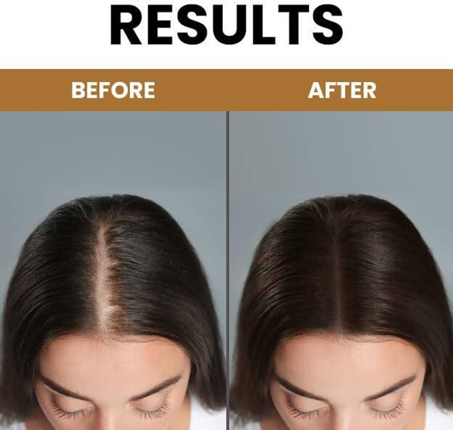 unisys Skin Fuel Hair Growth Oil with Redensyl - Image 2