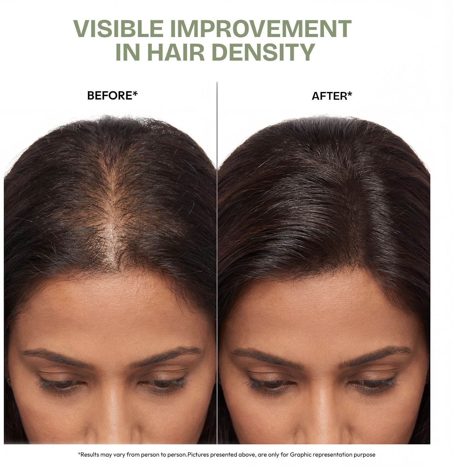 Image of Proskire Ultimate Hair Growth Oil | Reduces Hair Fall & Promotes Hair Growth |Lightweight Hair Oil